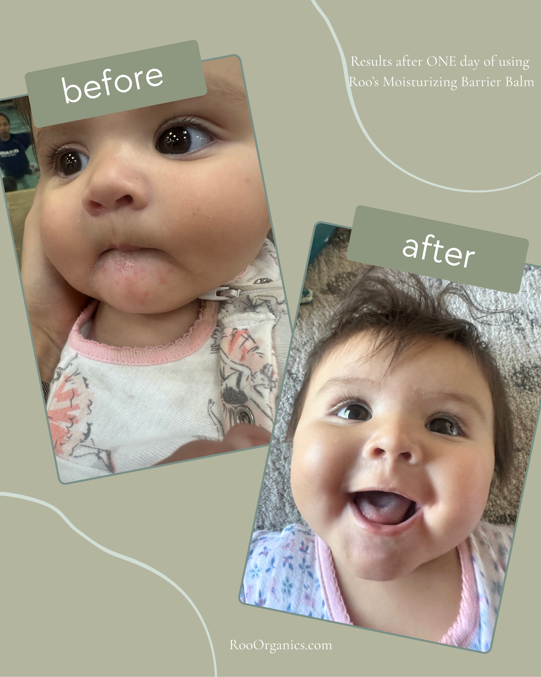 Before and after images of a baby showing improved skin condition and reduced irritation on the cheeks and chin after one day of using Moisturizing Barrier Balm.